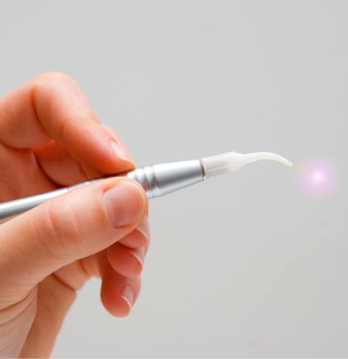 Hand holding a laser dental tool.